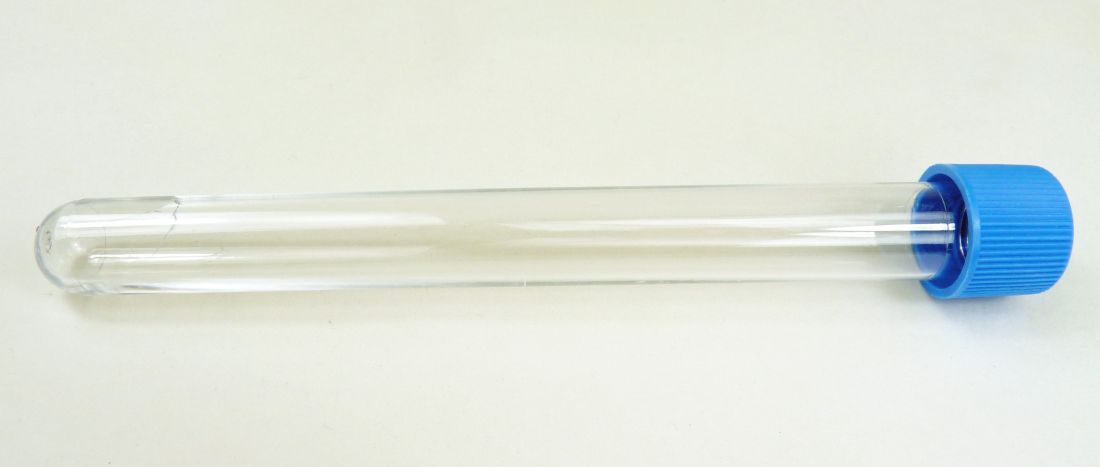 Reagenzröhrchen Plastik Reagenzröhrchen Plastik